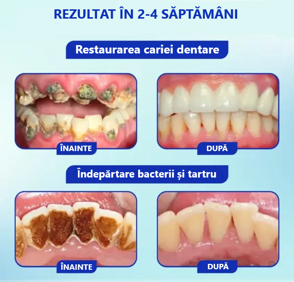 Pudră Orală - Tratament cu venin de albine