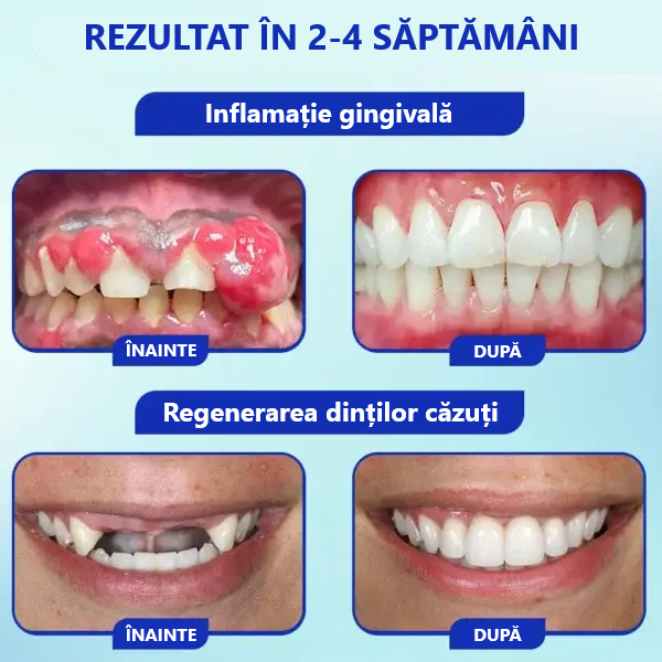 Pudră Orală - Tratament cu venin de albine