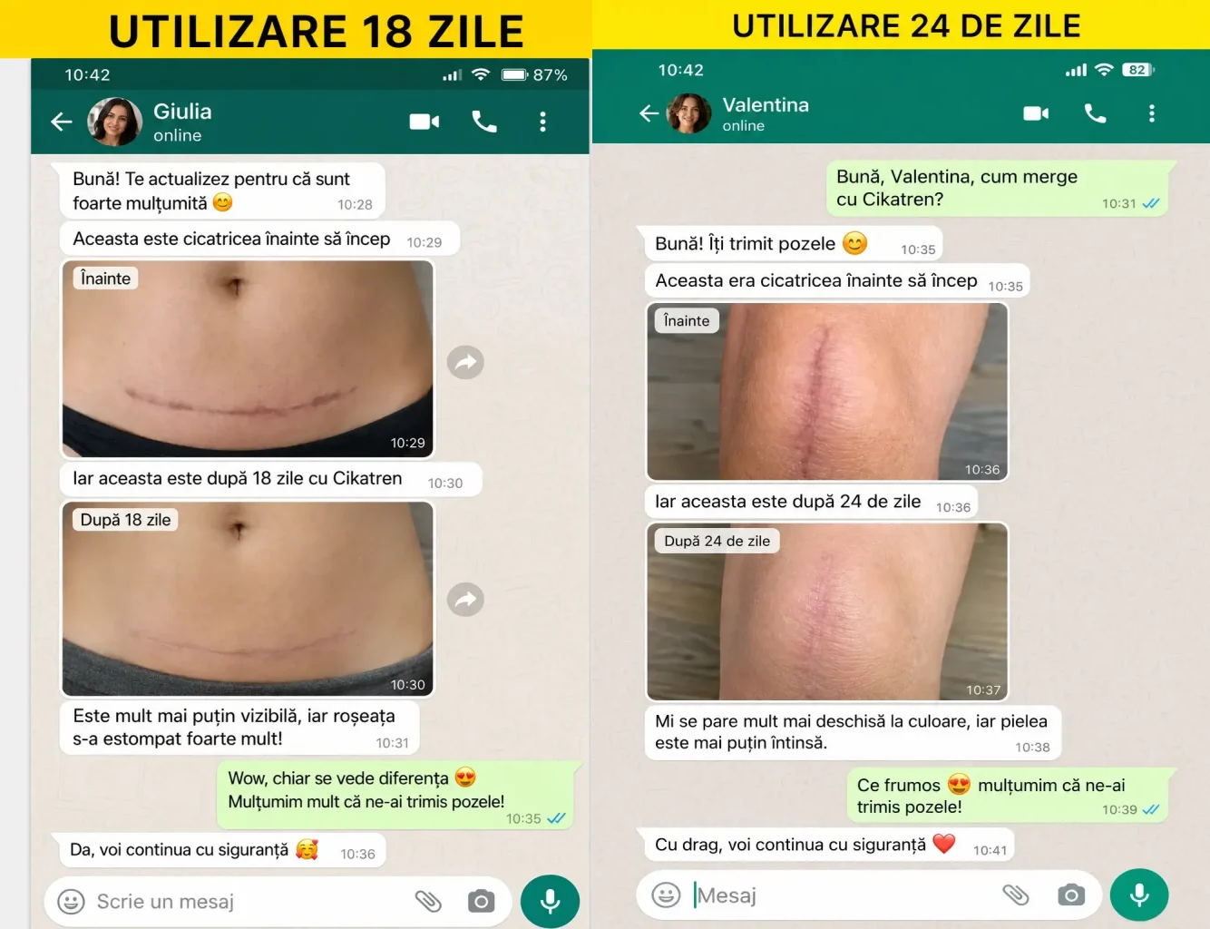 Cremă pentru Îngrijirea Cicatricilor cu Niacinamidă ScarCalm Pro™